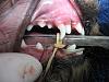 Retained Deciduous Teeth (Baby teeth)