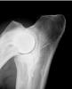 Elbow Dysplasia in Dogs, Symptoms , Diagnosis, Prevention and Treatment