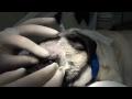 DrGregDVM - Removing an Eye in a Pug-Contains Graphic Surgery Scenes